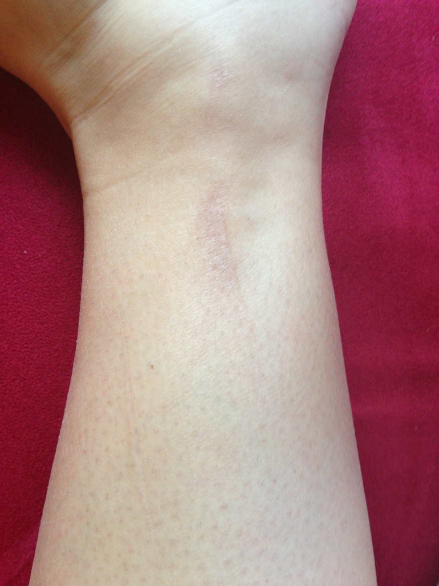 Not to terrible, but you can still see the three distinct scars from falling through a chair!  I love it :)